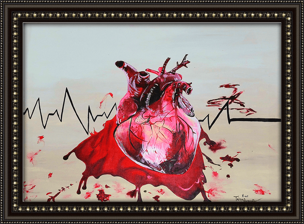 BLEEDING HEART Painting Nanitart